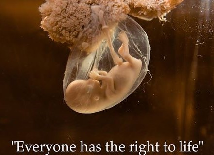 RIGHT TO LIFE - Everyone has the Right to Life